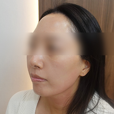After