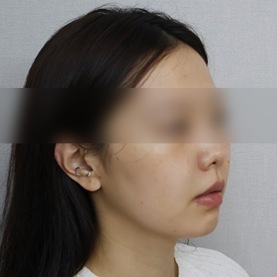 After