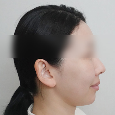 After