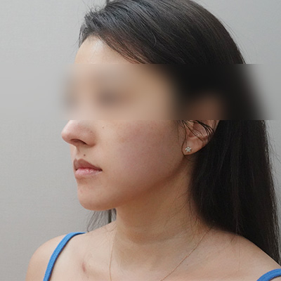 After