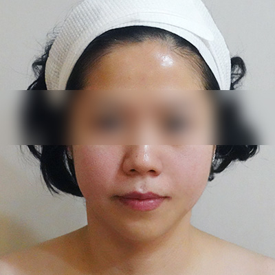 After