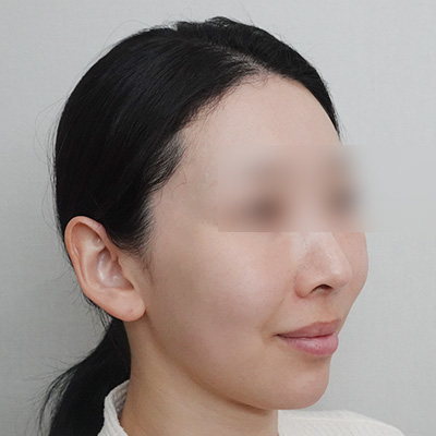 After
