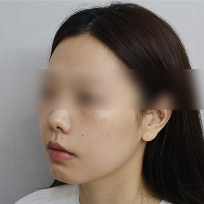 After