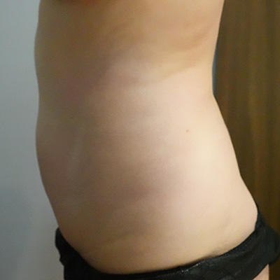 After