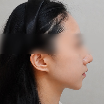 After